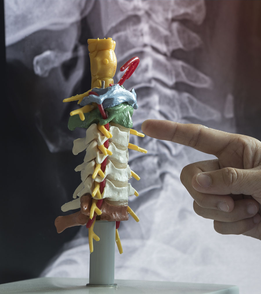 cervical spine surgical procedures with dr. joseph albano