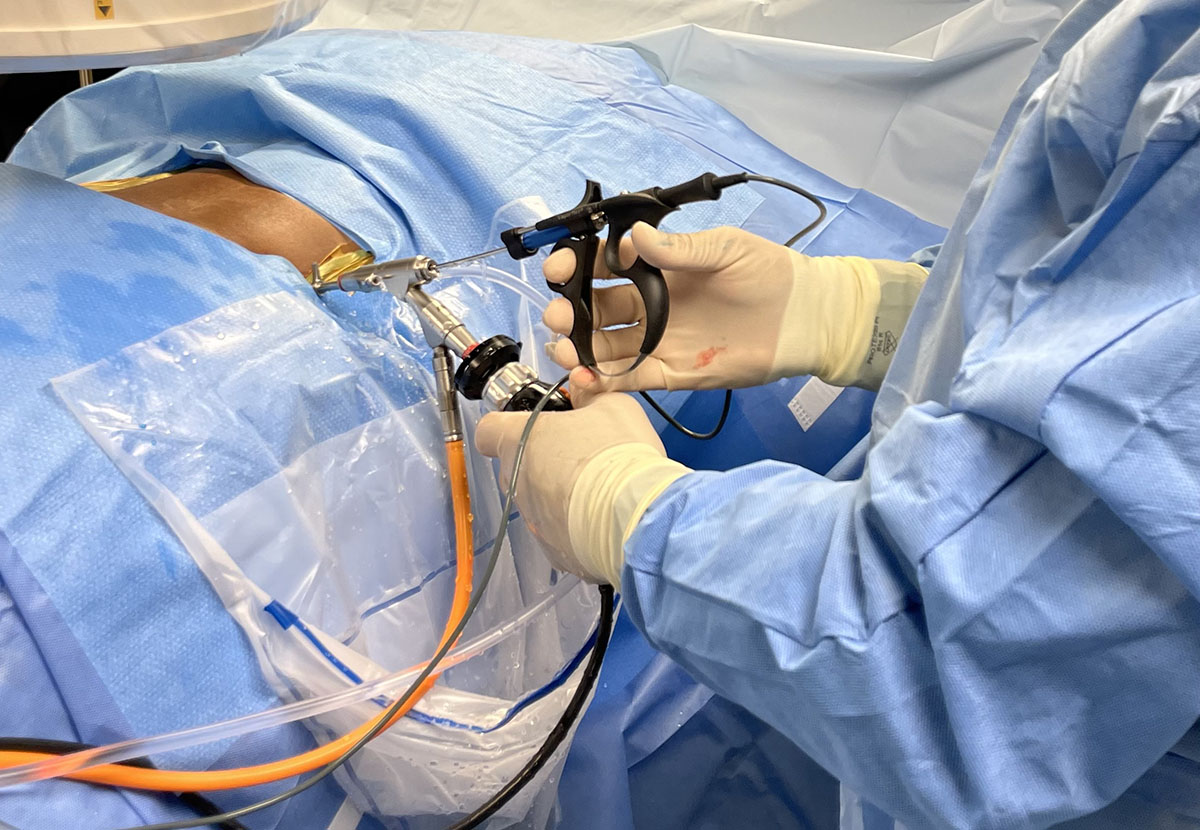 minimally invasive endoscopic spine surgery with dr. joseph albano